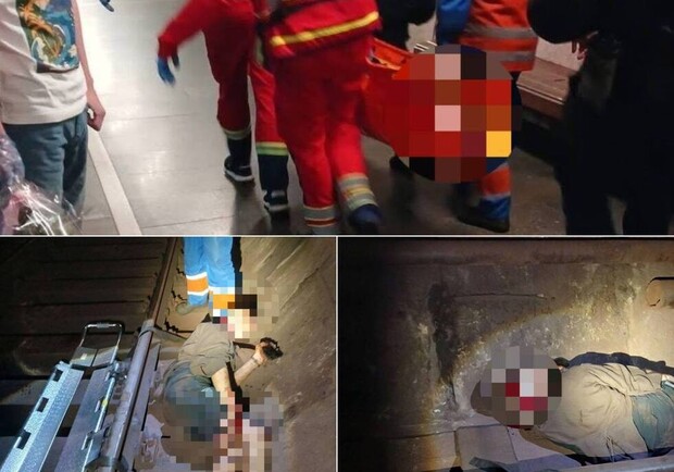 Замість вірусного відео – перелом ноги та струс мозку: в київському метрополітені ледь не загинув 19-річний блогер 